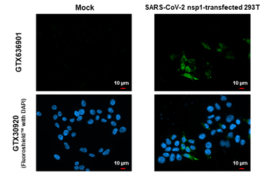 Anti-SARS-CoV-2 (COVID-19) nsp1 antibody [HL1435] used in Immunocytochemistry/ Immunofluorescence (ICC/IF). GTX636901
